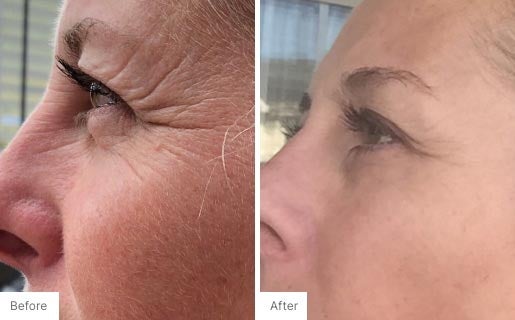 5 - Before and After Real Results image of a woman's face.